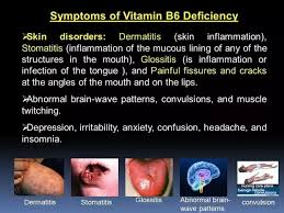 The side effects of thiamine mononitrate. Can Taking Vitamin B6 Help With Lowering Anxiety Quora