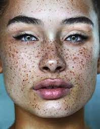 Persephone S Skull Collection Cute Freckles Freckles Freckle Face