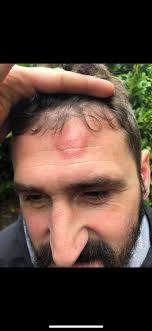 Did you know that all 5 of our scare mazes are indoor attractions,  including The Attic: Terror of the Towers? 🔥 Trade some rain showers for  scares and cold weather to spine-chilling