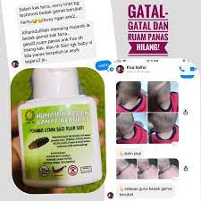 Petua hilangkan batuk dan kahak bayi d'sunz via dsunzsulaiman.blogspot.com. Humaira Bedak Gamat Berubat Talcum Powder Gatal Gatal Ruam Panas Ruam Bayi Rashes Luka Kurap Panau Kayap Shopee Malaysia
