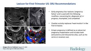 Image result for First Trimester Ultrasound