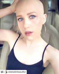 Bald Is Better On Women On Instagram Repost Shebaldnbeautiful Singapore Sophia Is That You Half Shaved Hair Bald Girl Bald Women