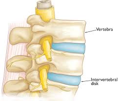 In either case, backbone can manage the process, providing a greatly simplified and clarified client experience. Kyphosis Roundback Of The Spine Orthoinfo Aaos