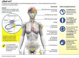La esclerosis múltiple (em) es la más común de las enfermedades inflamatorias que dañan la ¿cuáles son los síntomas de la esclerosis múltiple? Esclerosis Multiple La Discapacidad De Jovenes