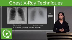 chest x ray techniques inspiration penetration rotation radiology lecturio