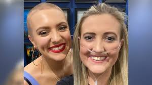 'Deadpool' skin condition inspires sister's head shave