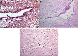 Todas las últimas noticias de tecnología en colombia y el mundo: Frontiers Age Related Metabolic Pathways Changes In Dental Follicles A Pilot Study Oral Health