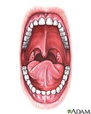 Mouth Disorders Medlineplus Discover Information On All Of These Common Disorders Oral Cancer