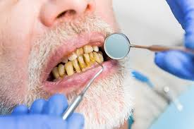 Geriatric Dental Care