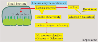 Image result for Lactase Deficiency