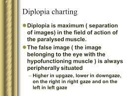 Approach To A Patient With Diplopia Ppt Video Online Download