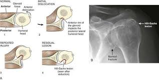 Pin By Rula Sq On My Studying Radiology Radiology Residency Study