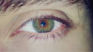Central heterochromia is when there is an inner ring that is a different color than the outer area of the iris. Square Shaped Central Heterochromia Wow Look At That