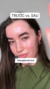 Kem giảm đỏ viral #Cicapair đang có mặt trên cửa hàng TikTok Shop CHÍNH  HÃNG của Dr.Jart+ 💚💚 Công thức kết hợp giữa makeup và skincare, Cicapair  Tiger Grass Color Correcting Treatment giúp che phủ vết ...