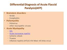 Weakness in the legs and arms. A 13 Years Old Girl With Acute Flaccid Paralysis F Ahmadabadi Child Neurologist Ppt Download