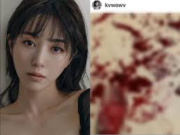 Maybe you would like to learn more about one of these? Former Aoa Member Mina Lashes Out At Haters With A Self Harm Photo Hype Malaysia