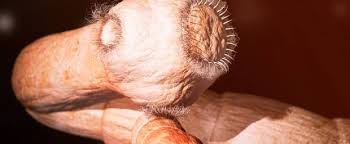Häufig wird der bandwurm in menschen bemerkt, wenn man im stuhl winzige, weiße, reiskornähnliche wurmeier oder die larven entdeckt. Bandwurmer Cestoden Ansteckung Symptome Behandlung
