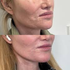 Danielle Stark, PA-C