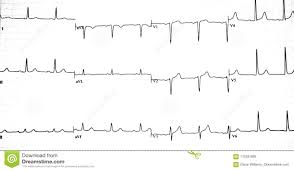 Ekg Graph Printout Stock Image Image Of Electrocardiogram
