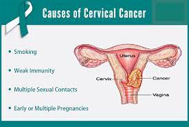 Pain in the pelvis or low in the belly. Cervical Cancer Cancer Association Of Namibia Wo30