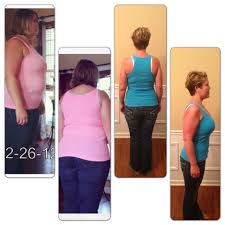 Lap Band Results 68 Lbs In 6 Months Lap Band Lap Band Surgery Lap Band Diet