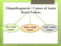 What is renal failure and why does it happen? Acute Renal Failure By Miss Santoshi Naik Assistant
