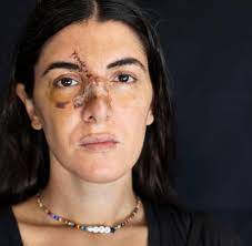 Wir sind unserer vision einer kostenlosen medizinischen versorgung in den strassen libanon schon ein beachtliches stück. Libanon Die Narben Der Menschen Von Beirut Welt