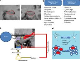 We did not find results for: The Hippocampus In Major Depression Evidence For The Convergence Of The Bench And Bedside In Psychiatric Research Molecular Psychiatry