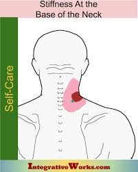 Pin On Headaches