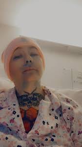 Aloma's Nose Surgery Controversy