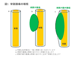 内科 脳神経内科 腎臓・高血圧内科 リウマチ・膠原病内科 循環器内科 糖尿病・代謝・内分泌内科 腫瘍・血液内科 呼吸器内科 接種 小児神経外来 皮膚科（小児診療） 小児一般外来 小児血液腫瘍外来 耳鼻咽喉科（小児診療） 産科 未熟児フォローアップ 眼科（小児診療） 小児循環器外来 小. é šé«„è…«ç˜ ç ‚æ™‚è¨ˆè…«ã®ç—‡çŠ¶ é šé«„è…«ã‚„ç ‚æ™‚è¨ˆè…«ãªã‚‰ç™½çŸ³è„Šæ¤Žã‚¯ãƒªãƒ‹ãƒƒã‚¯