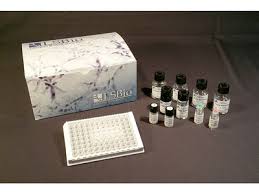 An antibody is a protein produced by the body's immune system when it detects harmful substances, called antigens. Casein Elisa Kits Biocompare