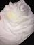 White Discharge During Pregnancy In Third Trimester