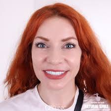 UK Resident's Smooth Dental Transformation Experience at Oz Clinic