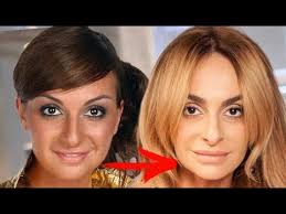 Поэтому многие списывают ее свежесть на постоянный уход, хорошую генетику и правильный образ жизни. Kak Menyalas Ekaterina Varnava S Detstva Do 2017 Youtube