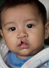 Mercy Outreach Surgical Team