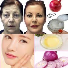Natural Onion-Based Face Whitening Recipe Using Onion