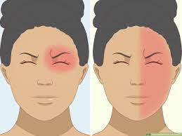 21 Ways To Get Rid Of A Headache - Wikihow
