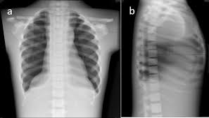 How are x rays harmful to the earth? Technique Radiation Safety And Image Quality For Chest X Ray Imaging Through Glass And In Mobile Settings During The Covid 19 Pandemic Springerlink