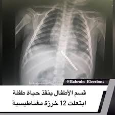 البحرين قسم الأطفال ينقذ حياة طفلة ابتعلت 12 خرزة مغناطيسية تمكن استشاري أمراض الجهاز الهضمي والكبد في قسم الأطف Lockscreen Lockscreen Screenshot Election