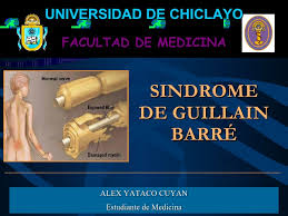 About 75% of patients have a history of preceding infection. Sindrome De Guillain Barre