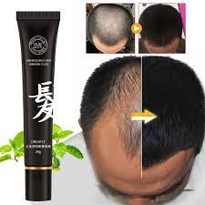 While genetics play a role in color and texture, there are quite a few things we can still do to manage hair growth, to promote stronger, more vibrant hair. 2 Pack Hair Growth Liquid Wild Growth Hair Oil Hair Growth Essence Help Hair Growing Fast Longer Anti Hair Loss Hair Thinning Treatment Hair Regrowth Treatment For Women Men