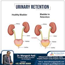Image result for Urinary Retention