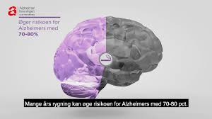 Sunt kosthold og hjernetrim er ikke nødvendigvis en motgift for å utvikle. Hvordan Kan Jeg Selv Forebygge Demens Alzheimer