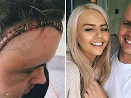 Ruffo's girlfriend, tahnee sims, is 27 years old and is from sydney. Johnny Ruffo Recovering Well After Brain Cancer Diagnosis