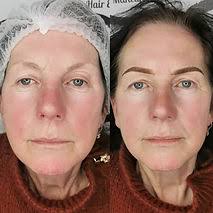 Permanent Brows