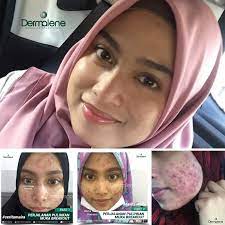 Alat dalam rahim dll) 8. Klinik Kulit Shah Alam Testimonial