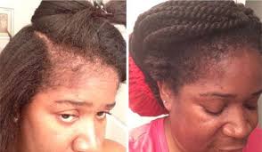 She has an expertise in natural hair and black women's issues. Jamaican Black Castor Oil For Hair Loss Before And After Pictures Castor Oil For Hair Growth Hair Growth Oil Jamaican Black Castor Oil