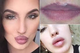Lip tattoo ruined my life: Make-up artist claims inking has made her so  self-conscious she won't even kiss her boyfriend |