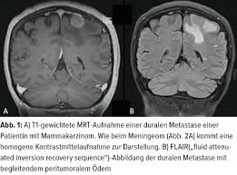 Herausforderungen Und Losungsansatze Onkologie Universimed Medizin Im Fokus